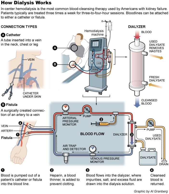 dialysis_graphic_final_101108